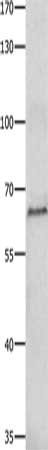 Gel: 8%SDS-PAGE, Lysate: 40 μg, Lane: Hela cells, Primary antibody: HDAC1 Antibody(HDAC1 Antibody) at dilution 1/100, Secondary antibody: Goat anti rabbit IgG at 1/8000 dilution, Exposure time: 1 minuteRabbit anti-Human HDAC1 Polyclonal Antibody