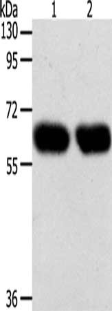 Gel: 10%SDS-PAGE, Lysate: 40 μg, Lane 1-2: Lncap cells, SKOV3 cells, Primary antibody: SYT7 Antibody(SYT7 Antibody) at dilution 1/200, Secondary antibody: Goat anti rabbit IgG at 1/8000 dilution, Exposure time: 1 minuteRabbit anti-Human SYT7 Polyclonal Antibody