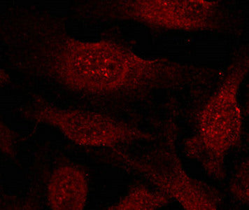 Immunofluorescence staining of methanol-fixed Hela cells showing cytoplasmic and nuclear staining using GSK3b(Ab-9) Antibody.Rabbit anti-Human GSK3B Polyclonal Antibody