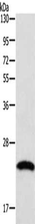 Gel: 10%SDS-PAGE, Lysate: 40 μg, Lane: A549 cells, Primary antibody: TAGLN2 Antibody(TAGLN2 Antibody) at dilution 1/250, Secondary antibody: Goat anti rabbit IgG at 1/8000 dilution, Exposure time: 2 minutesRabbit anti-Human TAGLN2 Polyclonal Antibody
