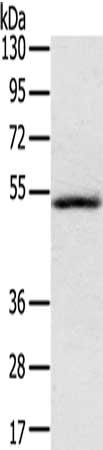Gel: 8%SDS-PAGE, Lysate: 40 μg, Lane: Human normal liver tissue, Primary antibody: IL17RB Antibody(IL17RB Antibody) at dilution 1/200, Secondary antibody: Goat anti rabbit IgG at 1/8000 dilution, Exposure time: 1 minute