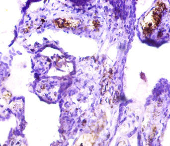 Immunohistochemistry of paraffin-embedded human placenta tissue using ICA1 Antibody at dilution of 1:50Rabbit anti-Human ICA1 Polyclonal Antibody