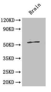 Western Blot  | Positive WB detected in: Mouse brain tissue  | All lanes: ICA1 antibody at 4µg/ml  | Secondary  | Goat polyclonal to rabbit IgG at 1/50000 dilution  | Predicted band size: 55, 58 kDa  | Observed band size: 55 kDaRabbit anti-Human ICA1 Polyclonal Antibody