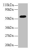 Western blot  | All lanes: ICA1 antibody at 2µg/ml + A549 whole cell lysate  | Secondary  | Goat polyclonal to rabbit IgG at 1/10000 dilution  | Predicted band size: 55, 58 kDa  | Observed band size: 55 kDaRabbit anti-Human ICA1 Polyclonal Antibody