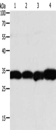 Gel: 12%SDS-PAGE, Lysate: 40 μg, Lane 1-4: Hela cells, Jurkat cells, human liver cancer tissue, mouse brain tissue, Primary antibody: NAPA Antibody(NAPA Antibody) at dilution 1/350, Secondary antibody: Goat anti rabbit IgG at 1/8000 dilution, Exposure time: 3 secondsRabbit anti-Human NAPA Polyclonal Antibody