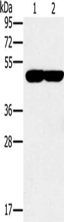Gel: 8%SDS-PAGE, Lysate: 40 μg, Lane 1-2: K562 cells, 293T cells, Primary antibody: PPOX Antibody(PPOX Antibody) at dilution 1/200, Secondary antibody: Goat anti rabbit IgG at 1/8000 dilution, Exposure time: 30 secondsRabbit anti-Human PPOX Polyclonal Antibody