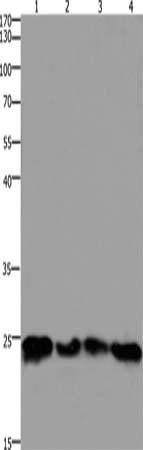 Gel: 10%SDS-PAGE, Lysate: 30 μg, Lane 1-4: 293T cells, hela cells, mouse lung tissue, Mouse brain tissue, Primary antibody: HMGB3 Antibody(HMGB3 Antibody) at dilution 1/400, Secondary antibody: Goat anti rabbit IgG at 1/8000 dilution, Exposure time: 1.5  minutesRabbit anti-Human HMGB3 Polyclonal Antibody