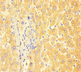 Immunohistochemistry of paraffin-embedded human liver tissue using APOC3 Antibody at dilution of 1:100Rabbit anti-Human APOC3 Polyclonal Antibody