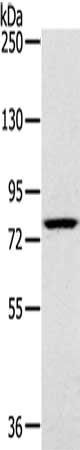 Gel: 6%SDS-PAGE, Lysate: 40 μg, Lane: K562 cells, Primary antibody: RPS6KA1 Antibody(RPS6KA1 Antibody) at dilution 1/400, Secondary antibody: Goat anti rabbit IgG at 1/8000 dilution, Exposure time: 5 secondsRabbit anti-Human RPS6KA1 Polyclonal Antibody