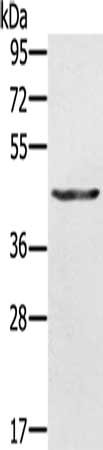 Gel: 10%SDS-PAGE, Lysate: 30 μg, Lane: A549 cells, Primary antibody: KRT31 Antibody(KRT31 Antibody) at dilution 1/500, Secondary antibody: Goat anti rabbit IgG at 1/8000 dilution, Exposure time: 10 seconds