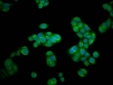 Immunofluorescence staining of PC-3 cells with HEXA Antibody at 1:100, counter-stained with DAPI. The cells were fixed in 4% formaldehyde, permeabilized using 0.2% Triton X-100 and blocked in 10% normal Goat Serum. The cells were then incubated with the antibody overnight at 4°C. The secondary antibody was Alexa Fluor 488-congugated AffiniPure Goat Anti-Rabbit IgG(H+L).Rabbit anti-Human HEXA Polyclonal Antibody