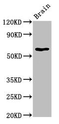 Western Blot | Positive WB detected in: Rat brain tissue | All lanes: HEXA antibody at 5.8μg/ml | Secondary | Goat polyclonal to rabbit IgG at 1/50000 dilution | Predicted band size: 61, 20 kDa | Observed band size: 61 kDaRabbit anti-Human HEXA Polyclonal Antibody