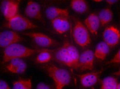 Immunofluorescence staining of methanol-fixed Hela cells using ASK1(Ab-83) Antibody.Rabbit anti-Human MAP3K5 Polyclonal Antibody