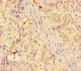 Immunohistochemistry of paraffin-embedded human adrenal gland tissue using MMP12 Antibody at dilution of 1:100Rabbit anti-Human MMP12 Polyclonal Antibody