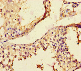 Immunohistochemistry of paraffin-embedded human testis tissue using MMP12 Antibody at dilution of 1:100Rabbit anti-Human MMP12 Polyclonal Antibody