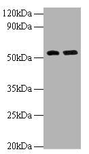 Western blot  | All lanes: MMP12 antibody at 2µg/ml  | Lane 1: Hela whole cell lysate  | Lane 2: NIH/3T3 whole cell lysate  | Secondary  | Goat polyclonal to rabbit IgG at 1/10000 dilution  | Predicted band size: 55 kDa  | Observed band size: 55 kDaRabbit anti-Human MMP12 Polyclonal Antibody