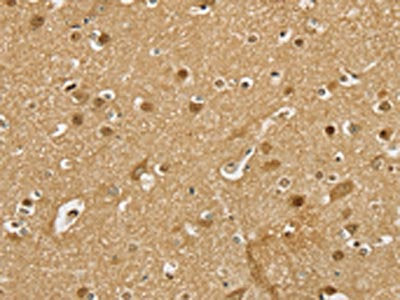 The image on the left is immunohistochemistry of paraffin-embedded Human brain  tissue using PSMC1 Antibody(PSMC1 Antibody) at dilution 1/25, on the right is treated with fusion protein. (Original magnification: ×200)Rabbit anti-Human PSMC1 Polyclonal Antibody