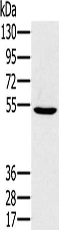 Gel: 8%SDS-PAGE, Lysate: 40 μg, Lane: 293T cells, Primary antibody: PSMC1 Antibody(PSMC1 Antibody) at dilution 1/350, Secondary antibody: Goat anti rabbit IgG at 1/8000 dilution, Exposure time: 40 secondsRabbit anti-Human PSMC1 Polyclonal Antibody