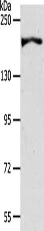 Gel: 8%SDS-PAGE, Lysate: 40 μg, Lane: HT29 cells, Primary antibody: AKAP12 Antibody(AKAP12 Antibody) at dilution 1/600, Secondary antibody: Goat anti rabbit IgG at 1/8000 dilution, Exposure time: 40 secondsRabbit anti-Human AKAP12 Polyclonal Antibody