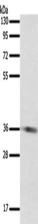 Gel: 10%SDS-PAGE, Lysate: 40 μg, Lane: 231 cells, Primary antibody: SULT1E1 Antibody(SULT1E1 Antibody) at dilution 1/500, Secondary antibody: Goat anti rabbit IgG at 1/8000 dilution, Exposure time: 30 secondsRabbit anti-Human SULT1E1 Polyclonal Antibody