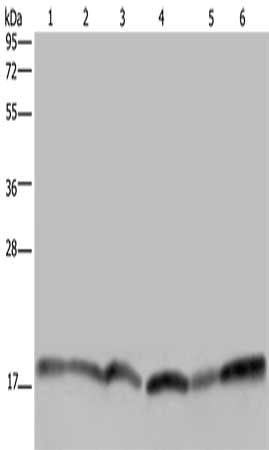 Gel: 10%SDS-PAGE, Lysate: 40 μg, Lane 1-6: Human brain malignant glioma tissue, Jurkat cells, Raji cells, 231 cells, human fetal brain tissue, Hela cells, Primary antibody: RHEB Antibody(RHEB Antibody) at dilution 1/300, Secondary antibody: Goat anti rabbit IgG at 1/8000 dilution, Exposure time: 5 secondsRabbit anti-Human RHEB Polyclonal Antibody