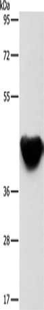 Gel: 8%SDS-PAGE, Lysate: 40 μg, Lane: Mouse heart tissue, Primary antibody: ACTA2 Antibody(ACTA2 Antibody) at dilution 1/500, Secondary antibody: Goat anti rabbit IgG at 1/8000 dilution, Exposure time: 1 minute