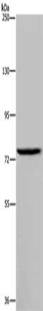 Gel: 6%SDS-PAGE, Lysate: 40 μg, Lane: Jurkat cells, Primary antibody: IL31RA Antibody(IL31RA Antibody) at dilution 1/250, Secondary antibody: Goat anti rabbit IgG at 1/8000 dilution, Exposure time: 10 minutes