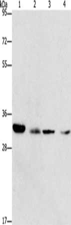 Gel: 8%SDS-PAGE, Lysate: 40 μg, Lane 1-4: 231 cells, NIH/3T3 cells, hela cells, human fetal liver tissue, Primary antibody: CDK2 Antibody(CDK2 Antibody) at dilution 1/275, Secondary antibody: Goat anti rabbit IgG at 1/8000 dilution, Exposure time: 1 minuteRabbit anti-Human CDK2 Polyclonal Antibody