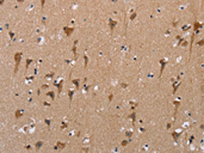 The image on the left is immunohistochemistry of paraffin-embedded Human brain  tissue using POMT1 Antibody(POMT1 Antibody) at dilution 1/50, on the right is treated with synthetic peptide. (Original magnification: ×200)Rabbit anti-Human POMT1 Polyclonal Antibody