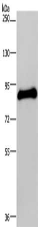 Gel: 6%SDS-PAGE, Lysate: 40 μg, Lane: Human testis tissue, Primary antibody: POMT1 Antibody(POMT1 Antibody) at dilution 1/200, Secondary antibody: Goat anti rabbit IgG at 1/8000 dilution, Exposure time: 1 minuteRabbit anti-Human POMT1 Polyclonal Antibody