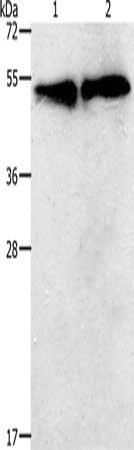 Gel: 12%SDS-PAGE, Lysate: 30 μg, Lane 1-2: K562 cells, hela cells, Primary antibody: TACR2 Antibody(TACR2 Antibody) at dilution 1/400, Secondary antibody: Goat anti rabbit IgG at 1/8000 dilution, Exposure time: 30 secondsRabbit anti-Human TACR2 Polyclonal Antibody