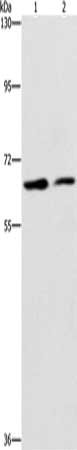 Gel: 6%SDS-PAGE, Lysate: 40 μg, Lane 1-2: RAW264.7, hepG2 cells, Primary antibody: CDC23 Antibody(CDC23 Antibody) at dilution 1/200, Secondary antibody: Goat anti rabbit IgG at 1/8000 dilution, Exposure time: 40 secondsRabbit anti-Human CDC23 Polyclonal Antibody
