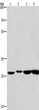 Gel: 8%SDS-PAGE, Lysate: 40 μg, Lane 1-4: Humna colon cancer tissue, mouse kidney tissue, mouse testis tissue, human fetal brain tissue, Primary antibody: KLF7 Antibody(KLF7 Antibody) at dilution 1/483.3, Secondary antibody: Goat anti rabbit IgG at 1/8000 dilution, Exposure time: 20 seconds