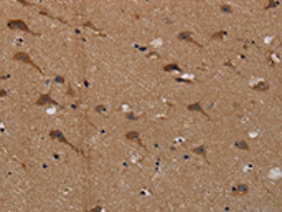 The image on the left is immunohistochemistry of paraffin-embedded Human brain  tissue using PDE5A Antibody(PDE5A Antibody) at dilution 1/50, on the right is treated with synthetic peptide. (Original magnification: ×200)Rabbit anti-Human PDE5A Polyclonal Antibody