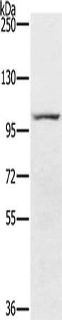 Gel: 6%SDS-PAGE, Lysate: 40 μg, Lane: 293T cells, Primary antibody: PDE5A Antibody(PDE5A Antibody) at dilution 1/200, Secondary antibody: Goat anti rabbit IgG at 1/8000 dilution, Exposure time: 2 minutesRabbit anti-Human PDE5A Polyclonal Antibody