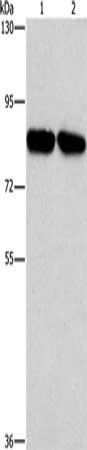Gel: 6%SDS-PAGE, Lysate: 40 μg, Lane 1-2: A431 cells, Raji cells, Primary antibody: CD2AP Antibody(CD2AP Antibody) at dilution 1/1000, Secondary antibody: Goat anti rabbit IgG at 1/8000 dilution, Exposure time: 1 secondRabbit anti-Human CD2AP Polyclonal Antibody