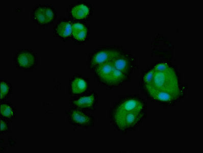 Immunofluorescent analysis of MCF-7 cells using AMH Antibody at dilution of 1:100 and Alexa Fluor 488-congugated AffiniPure Goat Anti-Rabbit IgG(H+L)Rabbit anti-Human AMH Polyclonal Antibody