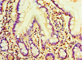 Immunohistochemistry of paraffin-embedded human small intestine tissue using AMH Antibody at dilution of 1:100Rabbit anti-Human AMH Polyclonal Antibody