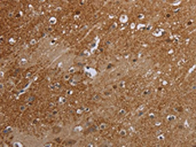 The image on the left is immunohistochemistry of paraffin-embedded Human brain  tissue using ERRFI1 Antibody(ERRFI1 Antibody) at dilution 1/35, on the right is treated with synthetic peptide. (Original magnification: ×200)Rabbit anti-Human ERRFI1 Polyclonal Antibody