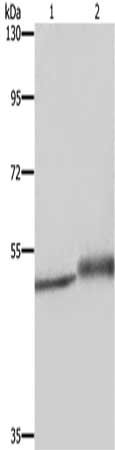 Gel: 8%SDS-PAGE, Lysate: 40 μg, Lane 1-2: Human brain malignant glioma tissue, HepG2 cells, Primary antibody: ERRFI1 Antibody(ERRFI1 Antibody) at dilution 1/400, Secondary antibody: Goat anti rabbit IgG at 1/8000 dilution, Exposure time: 5 minutesRabbit anti-Human ERRFI1 Polyclonal Antibody