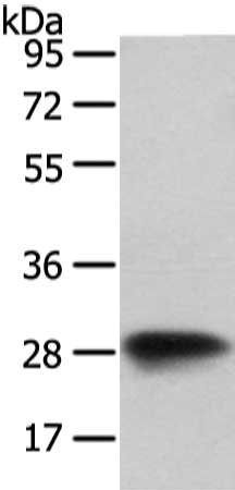 Gel: 8%SDS-PAGE, Lysate: 40 μg, Lane: NIH/3T3 cell, Primary antibody: VAPA Antibody(VAPA Antibody) at dilution 1/400 dilution, Secondary antibody: Goat anti rabbit IgG at 1/8000 dilution, Exposure time: 1 secondRabbit anti-Human VAPA Polyclonal Antibody