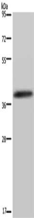 Gel: 8%SDS-PAGE, Lysate: 40 μg, Lane: LO2 cells, Primary antibody: DUSP4 Antibody(DUSP4 Antibody) at dilution 1/250, Secondary antibody: Goat anti rabbit IgG at 1/8000 dilution, Exposure time: 5 secondsRabbit anti-Human DUSP4 Polyclonal Antibody