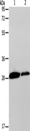 Gel: 12%SDS-PAGE, Lysate: 40 μg, Lane 1-2: SP20 cells, RAW264.7 cells, Primary antibody: CLEC7A Antibody(CLEC7A Antibody) at dilution 1/200, Secondary antibody: Goat anti rabbit IgG at 1/8000 dilution, Exposure time: 30 secondsRabbit anti-Human CLEC7A Polyclonal Antibody