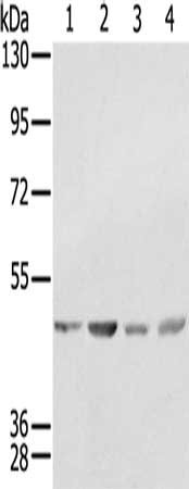 Gel: 8%SDS-PAGE, Lysate: 40 μg, Lane 1-4: K562 cells, 231 cells, Raji cells, hela cells, Primary antibody: SSB Antibody(SSB Antibody) at dilution 1/400, Secondary antibody: Goat anti rabbit IgG at 1/8000 dilution, Exposure time: 10 secondsRabbit anti-Human SSB Polyclonal Antibody