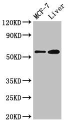 Western Blot  | Positive WB detected in: MCF-7 whole cell lysate, Mouse liver tissue  | All lanes: CBS antibody at 2.7µg/ml  | Secondary  | Goat polyclonal to rabbit IgG at 1/50000 dilution  | Predicted band size: 61, 62 kDa  | Observed band size: 61 kDa