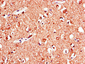 Immunohistochemistry of paraffin-embedded human brain tissue using the antibody at dilution of 1:100