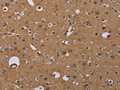 The image on the left is immunohistochemistry of paraffin-embedded Human brain  tissue using NPRL2 Antibody(NPRL2 Antibody) at dilution 1/40, on the right is treated with synthetic peptide. (Original magnification: ×200)Rabbit anti-Human NPRL2 Polyclonal Antibody