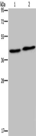 Gel: 10%SDS-PAGE, Lysate: 40 μg, Lane 1-2: Human fetal muscle tissue, mouse skeletal muscle tissue, Primary antibody: NPRL2 Antibody(NPRL2 Antibody) at dilution 1/200, Secondary antibody: Goat anti rabbit IgG at 1/8000 dilution, Exposure time: 1 minuteRabbit anti-Human NPRL2 Polyclonal Antibody