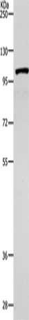 Gel: 8%SDS-PAGE, Lysate: 40 μg, Lane: 231 cells, Primary antibody: TNK2 Antibody(TNK2 Antibody) at dilution 1/1800, Secondary antibody: Goat anti rabbit IgG at 1/8000 dilution, Exposure time: 2 minutesRabbit anti-Human TNK2 Polyclonal Antibody