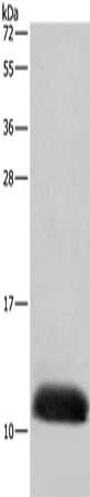 Gel: 10%SDS-PAGE, Lysate: 40 μg, Lane: A549 cells, Primary antibody: COX6B2 Antibody(COX6B2 Antibody) at dilution 1/400, Secondary antibody: Goat anti rabbit IgG at 1/8000 dilution, Exposure time: 5 secondsRabbit anti-Human COX6B2 Polyclonal Antibody